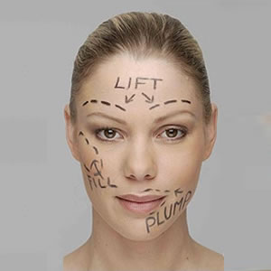 Skin tightening is one of the popular plastic surgery types.